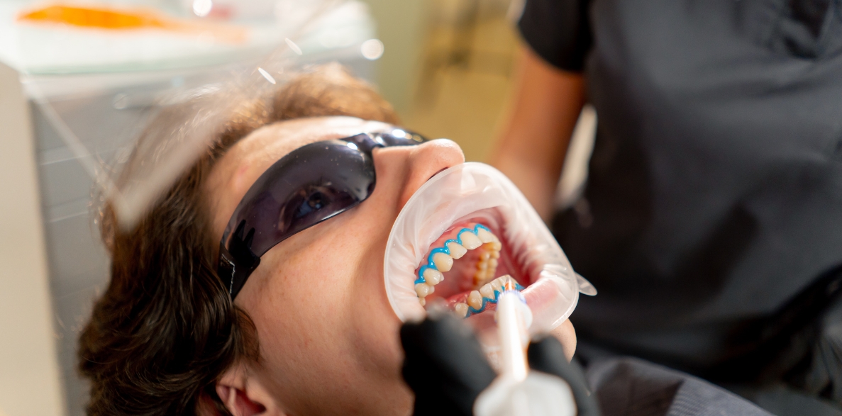 maintaining your cosmetic dental results in holden tips for 2025