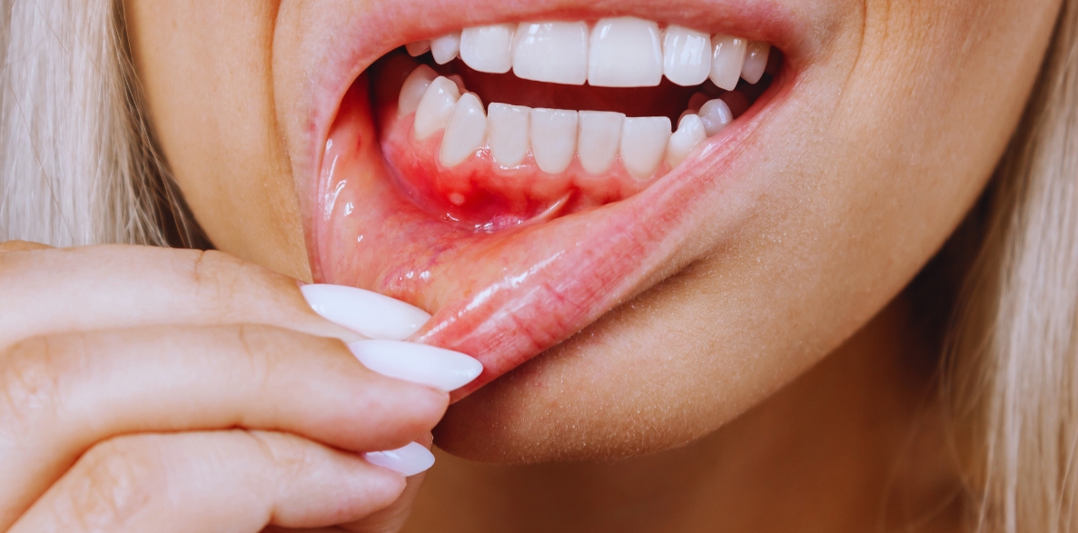 does gum disease affect your overall health