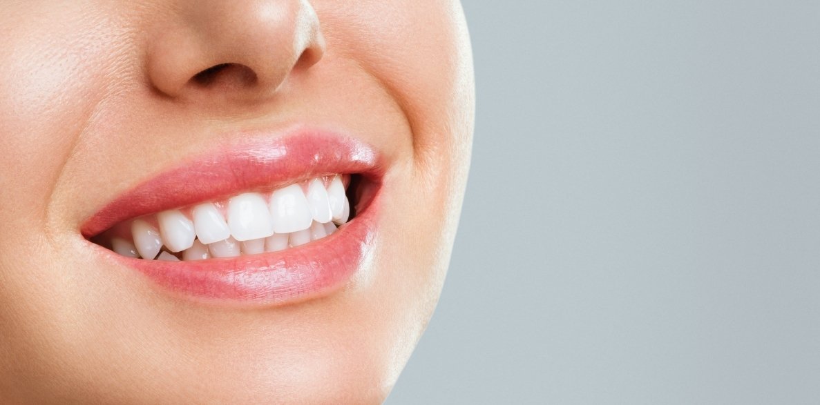 teeth whitening solutions after valentines day treats