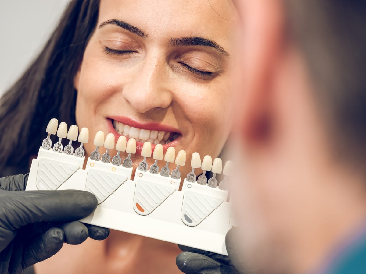 Veneers in Paxton