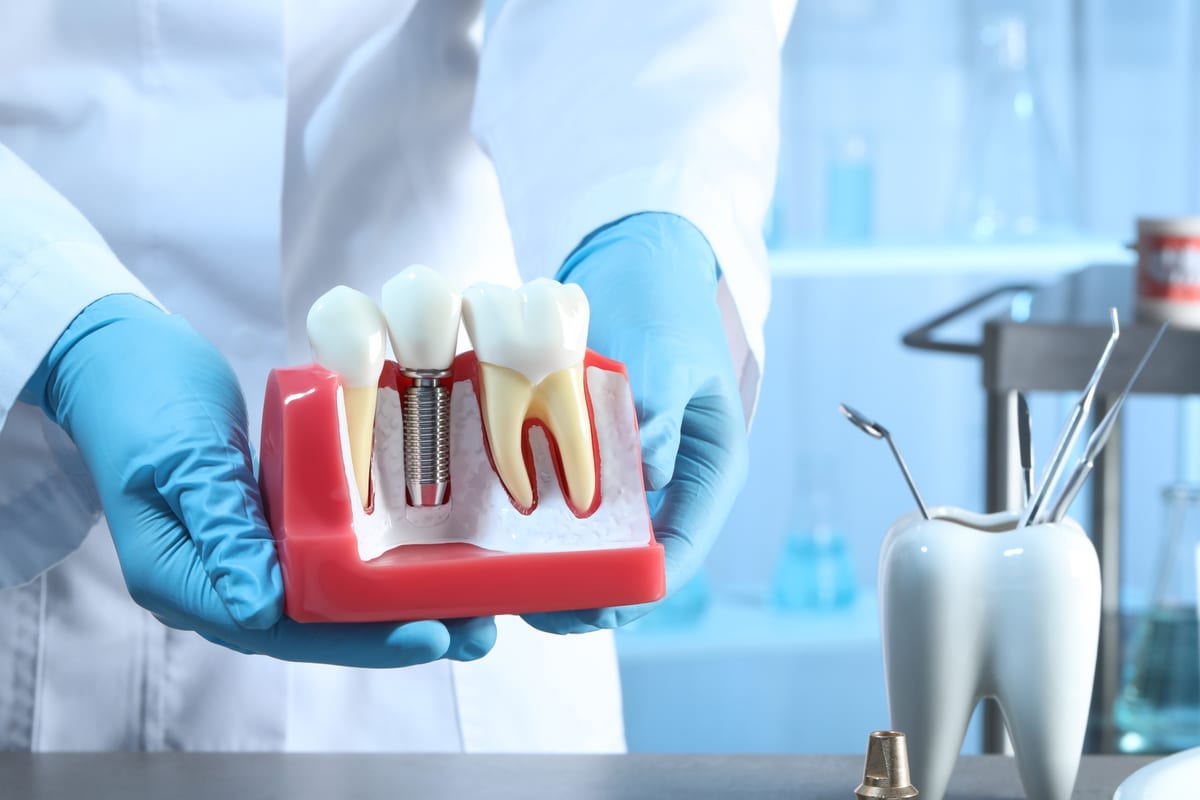Dental Implants in Holden