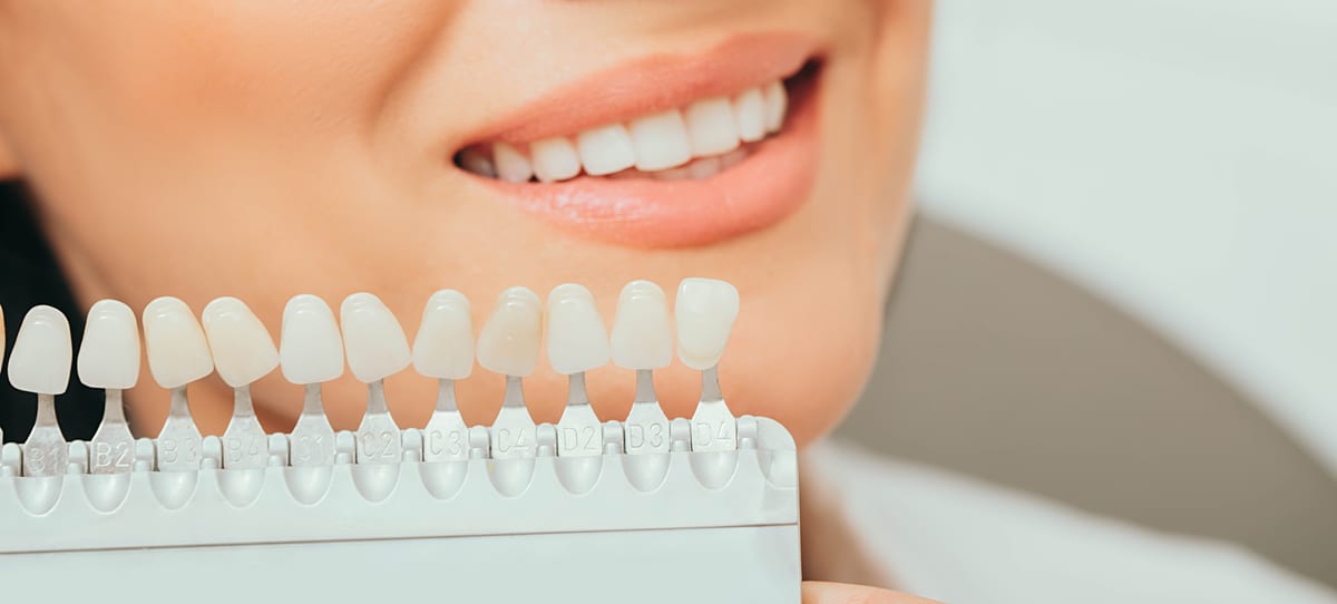 Veneers in Paxton